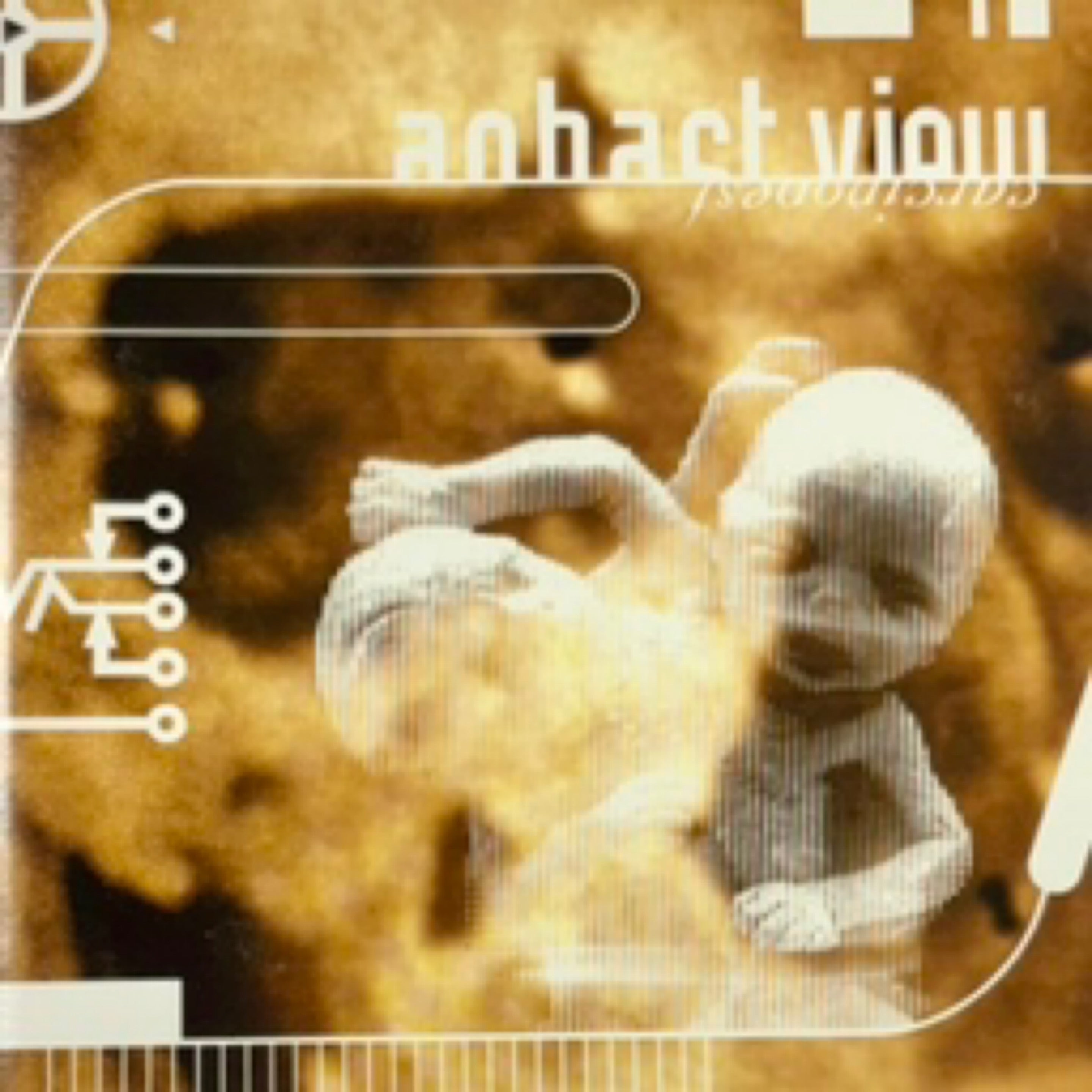 AGHAST VIEW, Carcinopest (1998) CD